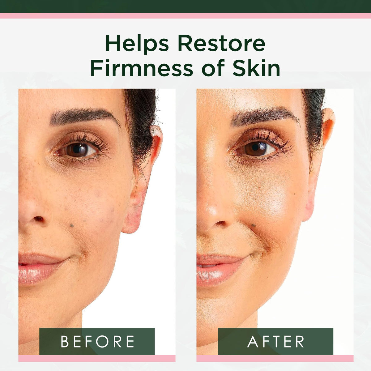 Tree of Life subtle before and after showing firmer-looking skin