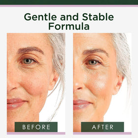 Tree of Life serum texture on skin close-up highlighting fast absorption benefit