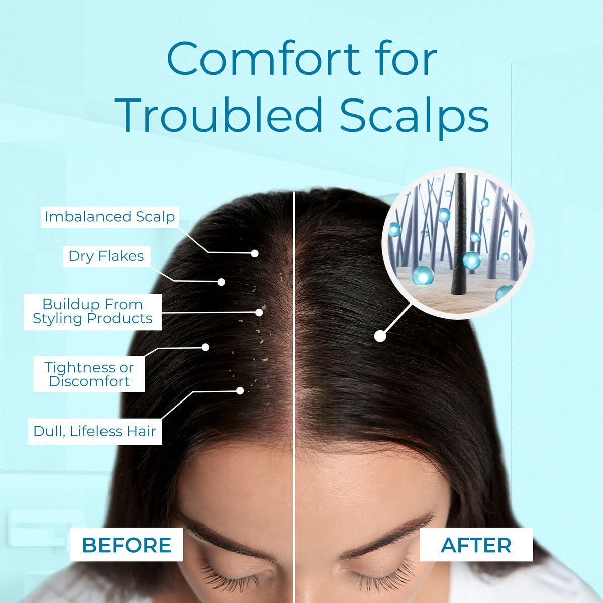 Tree To Tub being applied to part line to target dry scalp relief