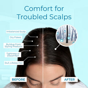 Tree To Tub being applied to part line to target dry scalp relief