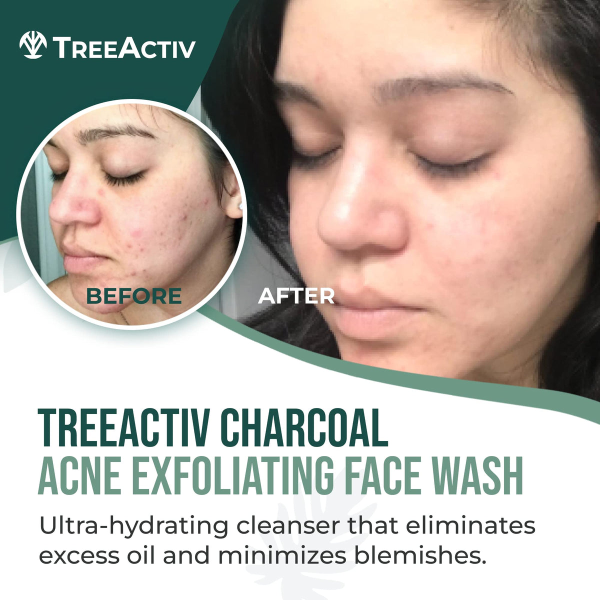 TreeActiv close-up of gel lather texture for gentle exfoliation