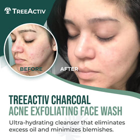 TreeActiv close-up of gel lather texture for gentle exfoliation