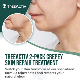 TreeActiv cream texture close-up displaying hydration-rich hyaluronic boost