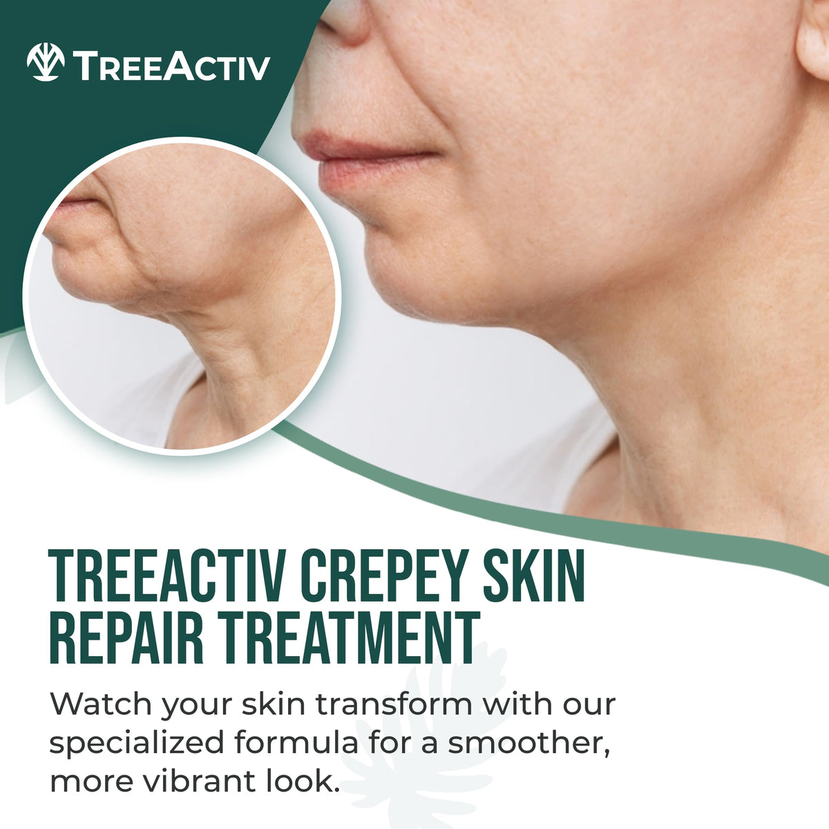 TreeActiv cream texture close-up illustrating rich hydration
