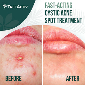TreeActiv paste texture close-up highlighting thick paste for precise dabs