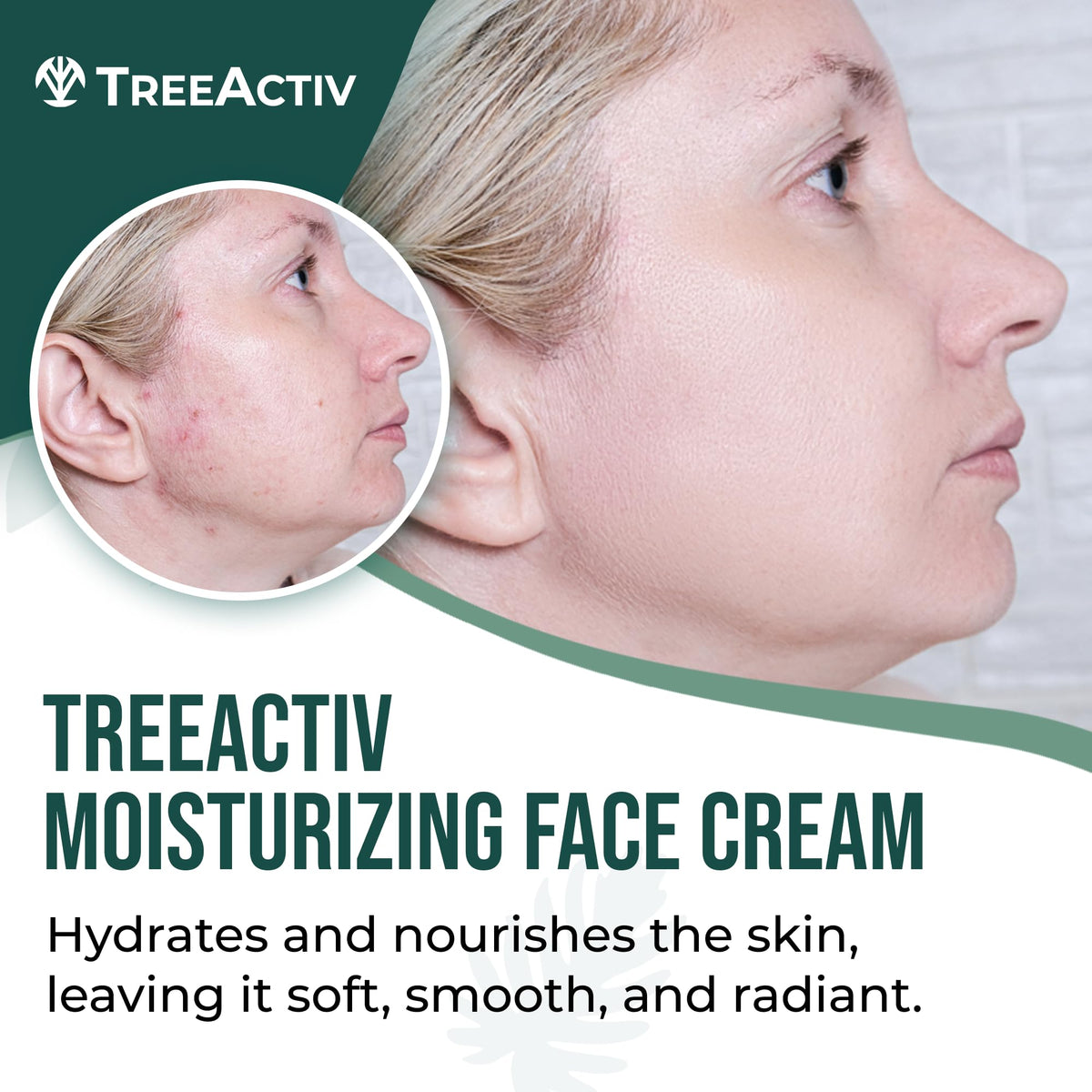 TreeActiv tube cap detail highlighting secure closure and travel-ready benefit