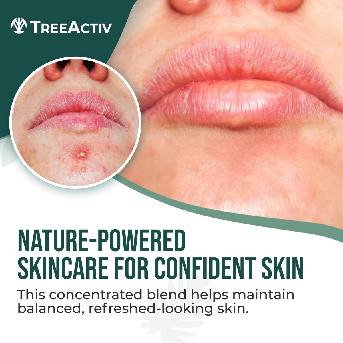 TreeActiv tube close-up label highlighting ingredients and clarity