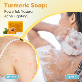 Treeroot soap with turmeric root and lemon oil arranged to show natural ingredient focus