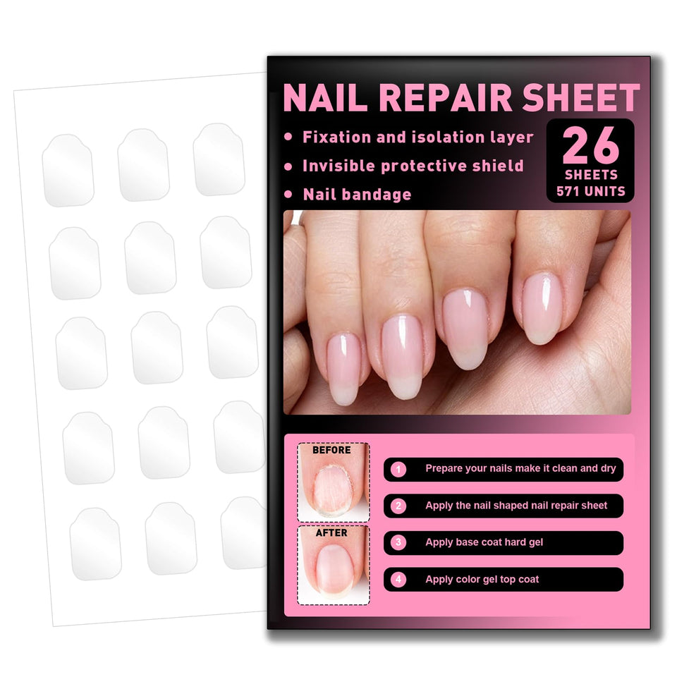 TRESSON front packaging showing kit contents and 571-piece count for fast fixes