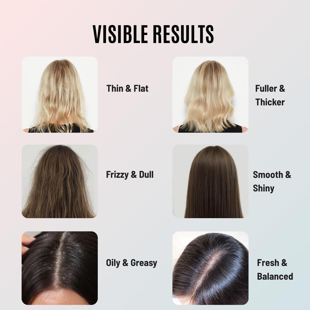 Tricholoy+ before and after root lift demonstrating fuller-looking hair