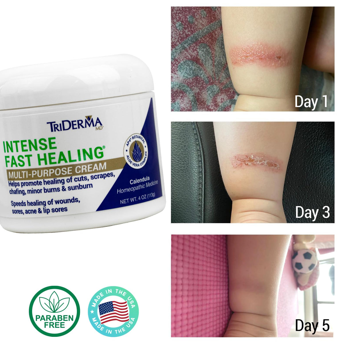 TriDerma being applied to hand to soothe and speed minor skin recovery