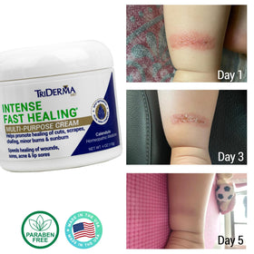 TriDerma being applied to hand to soothe and speed minor skin recovery