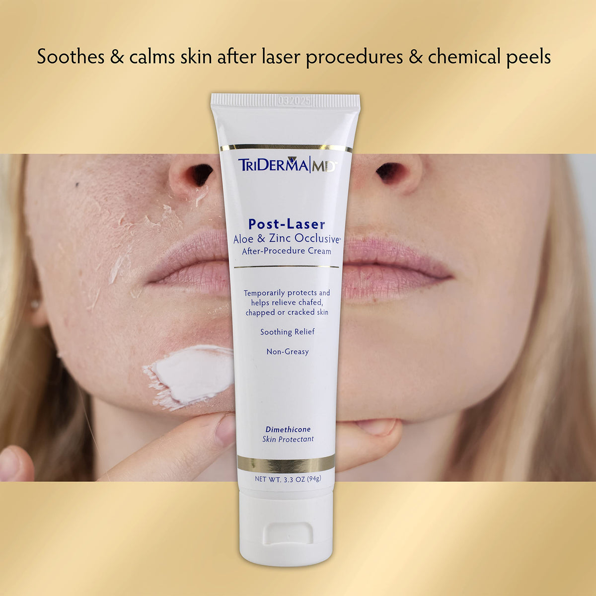 TriDerma cream texture on fingertip demonstrating smooth occlusive consistency