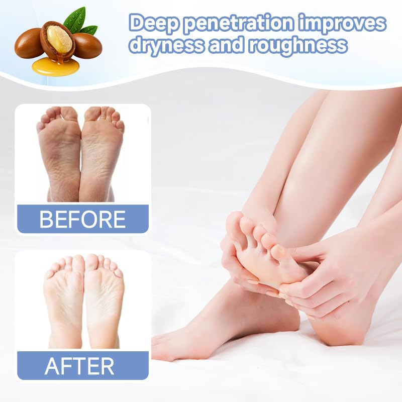 TrySafe before-and-after feet comparison showing smoother, softer results
