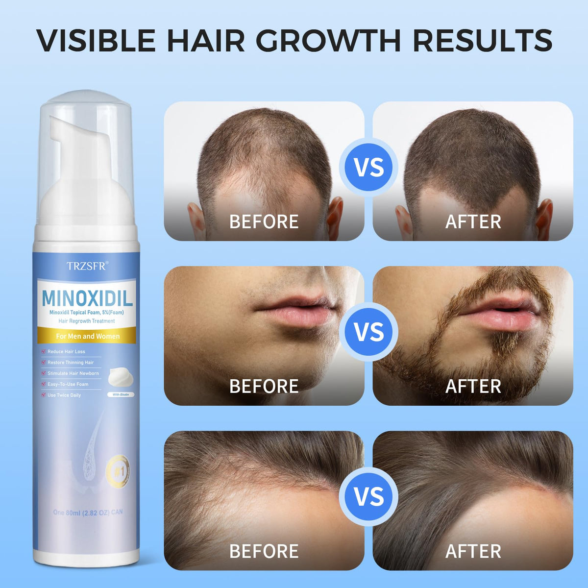 Trzsfr application on scalp with silicone brush for even distribution