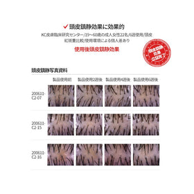 TS SHAMPOO in-shower use illustrating improved scalp comfort and cleansing