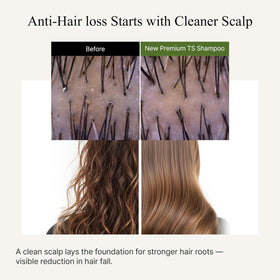 TS SHAMPOO ingredient label with biotin and zinc pyrithione highlighted for strength