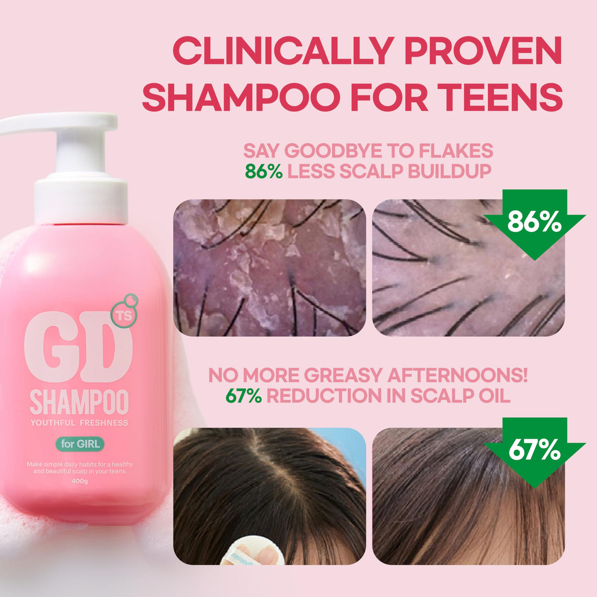TS SHAMPOO frothy lather on wet hair, illustrates effective buildup removal