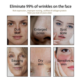 TTYRBF application under-eye showing gentle use and targeted smoothing