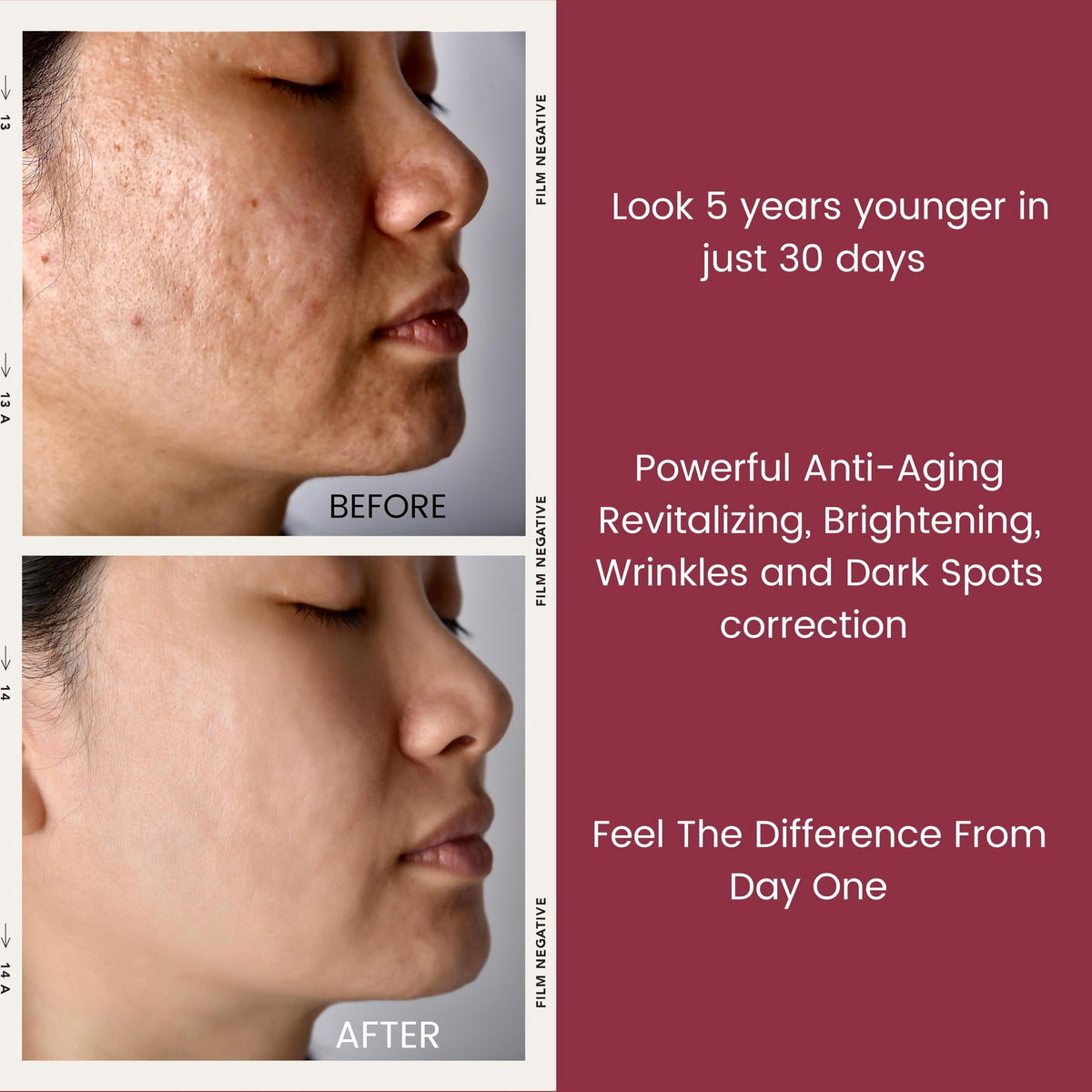 TURBINNE before and after composite illustrating texture improvement