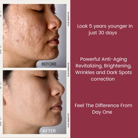 TURBINNE before and after composite illustrating texture improvement