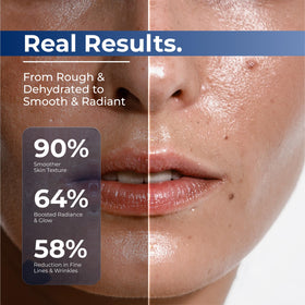Turmskin application before and after cheek area showing visible plumping