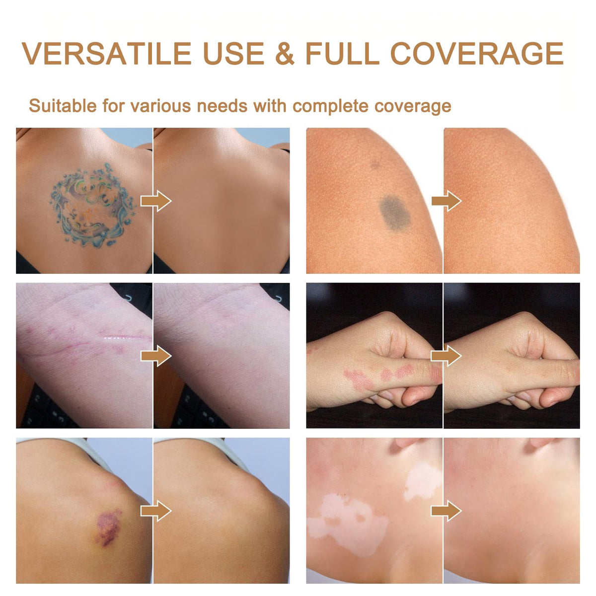 TWMKLP before and after coverage showing concealed tattoo benefit