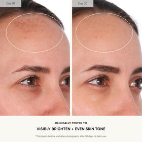 U Beauty label closeup showing active list and precision delivery benefit