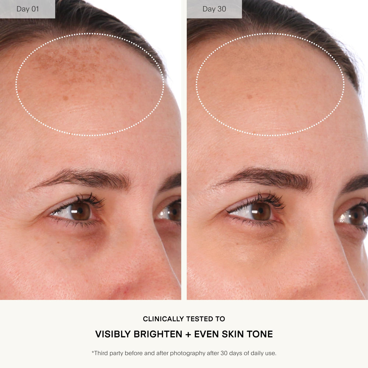 U Beauty ingredient panel close-up detailing acids and antioxidants