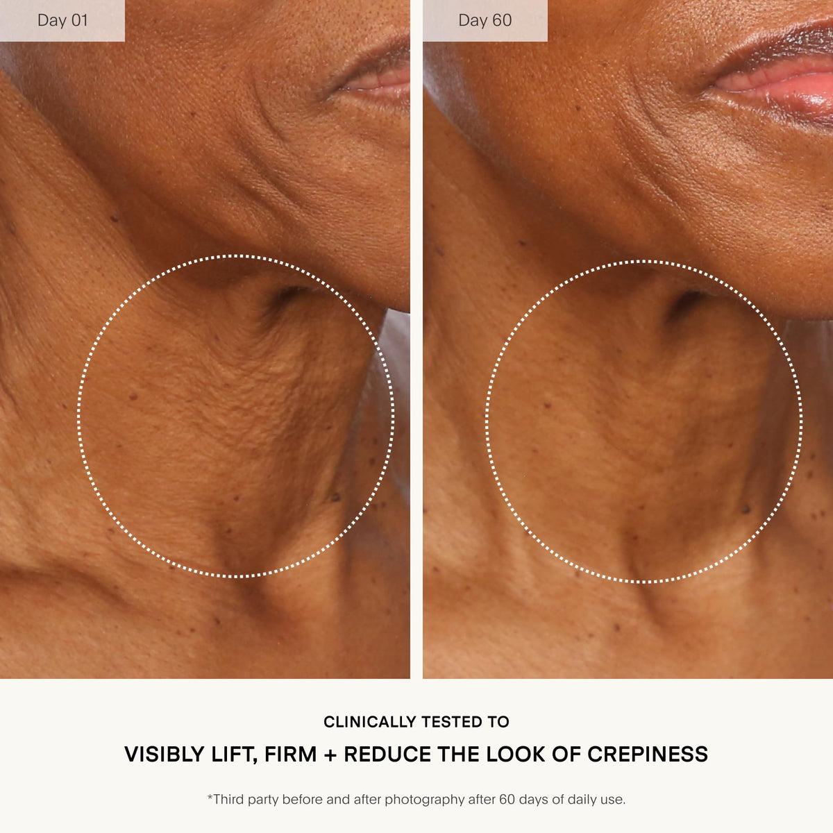 U Beauty application on neck demonstrating lifting massage benefit