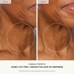 U Beauty application on neck demonstrating lifting massage benefit
