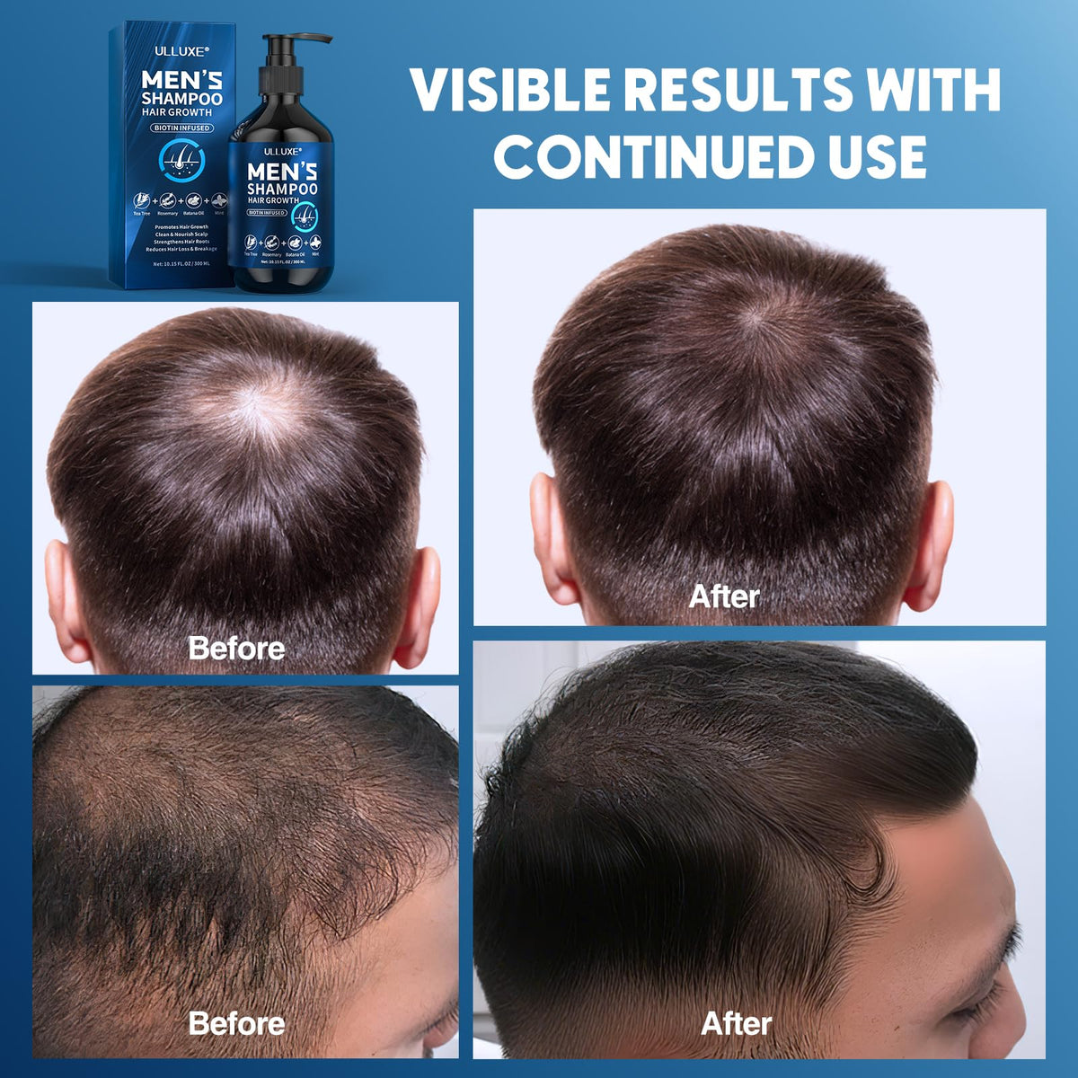 ulluxe rosemary and tea tree ingredients display supporting scalp health