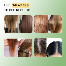 Umex oil applied to scalp during massage to demonstrate nourishment benefits