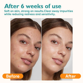 UNIMADE makeup removal demonstration showing lint-free cleansing benefit