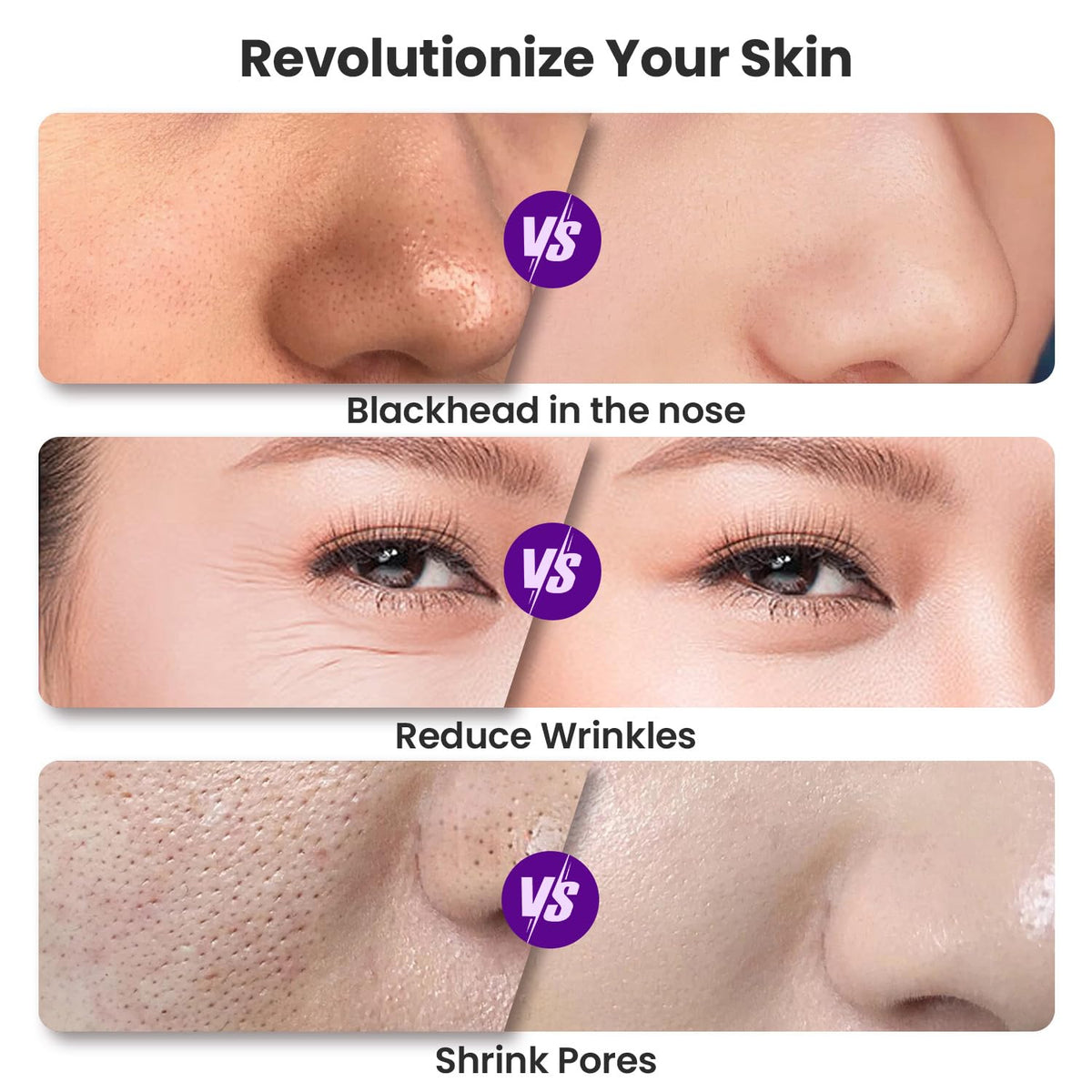 UNOISETION suction head detail showing sealed rim for consistent pore-clearing performance