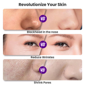 UNOISETION suction head detail showing sealed rim for consistent pore-clearing performance