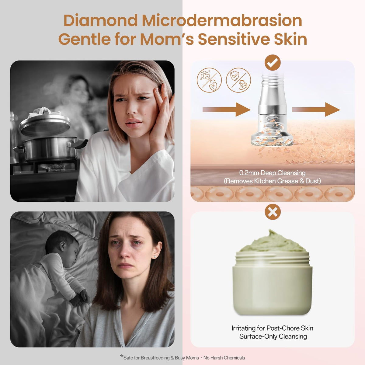 UNOISETION diamond tips close-up showing varied grit for precise exfoliation