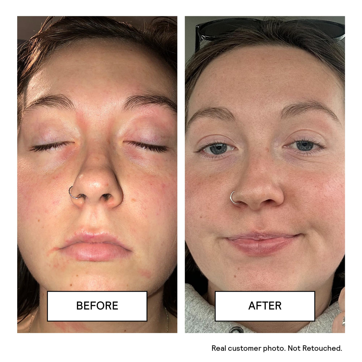 Untoxicated illustration of ceramides and hyaluronic acid supporting skin barrier health