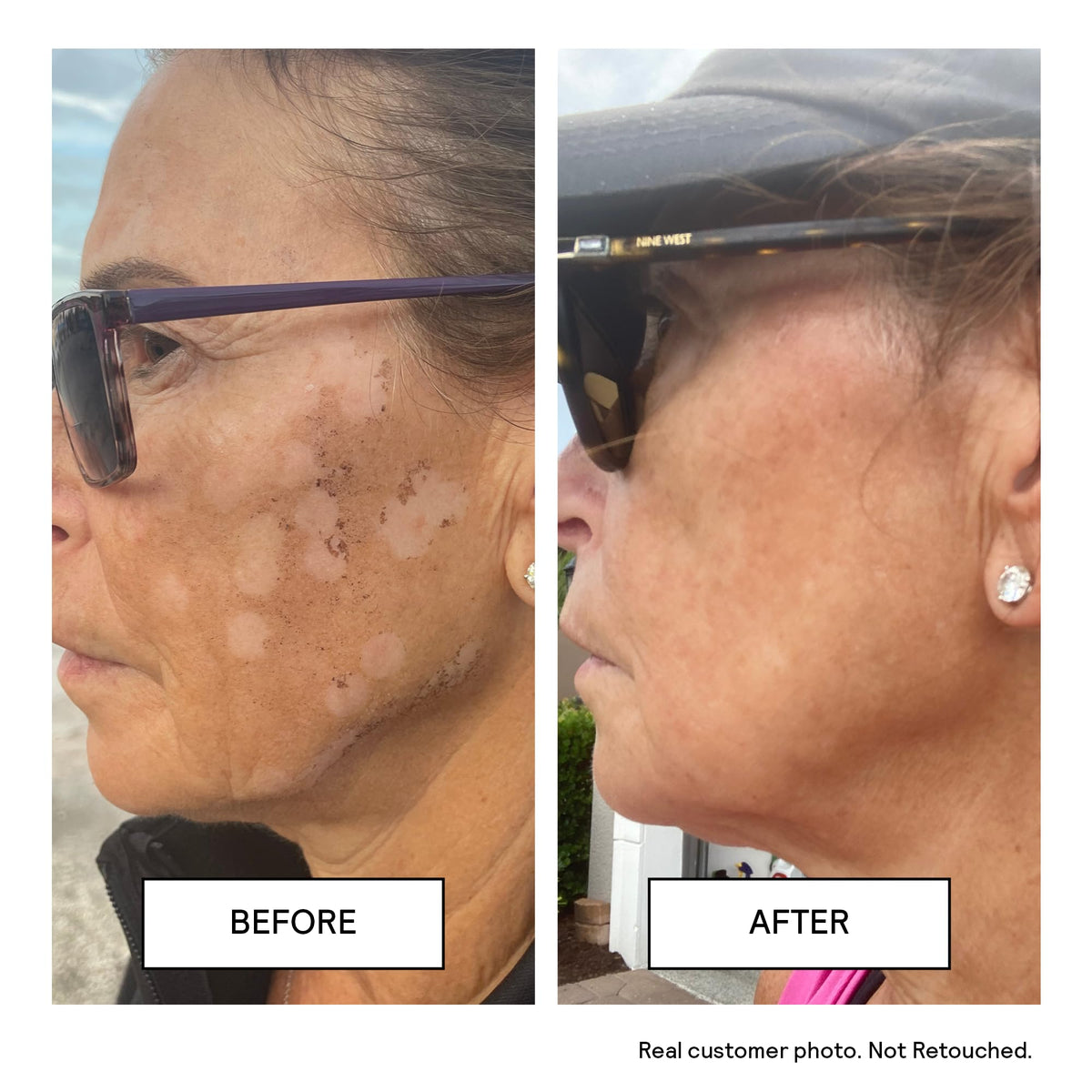 Untoxicated in travel bag lifestyle scene for on-the-go sensitive skin care