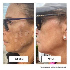 Untoxicated in travel bag lifestyle scene for on-the-go sensitive skin care