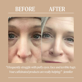 UpCircle ingredients label showing coffee, hyaluronic acid and botanical extracts