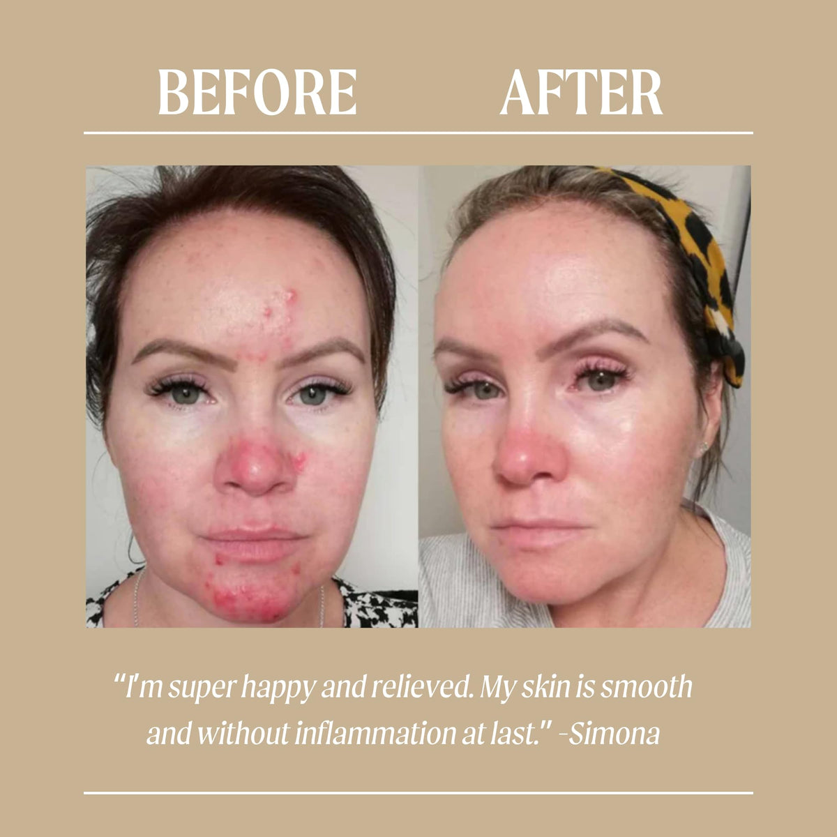 UPCIRCLE applying cream on hand illustrating lightweight hydration benefit