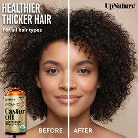 UpNature castor oil drop close-up highlighting rich texture and nourishment
