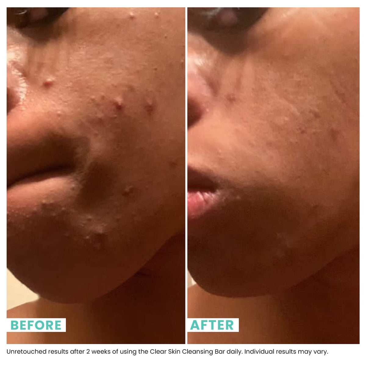Urban Skin Rx close texture shot highlighting creamy lather and exfoliant