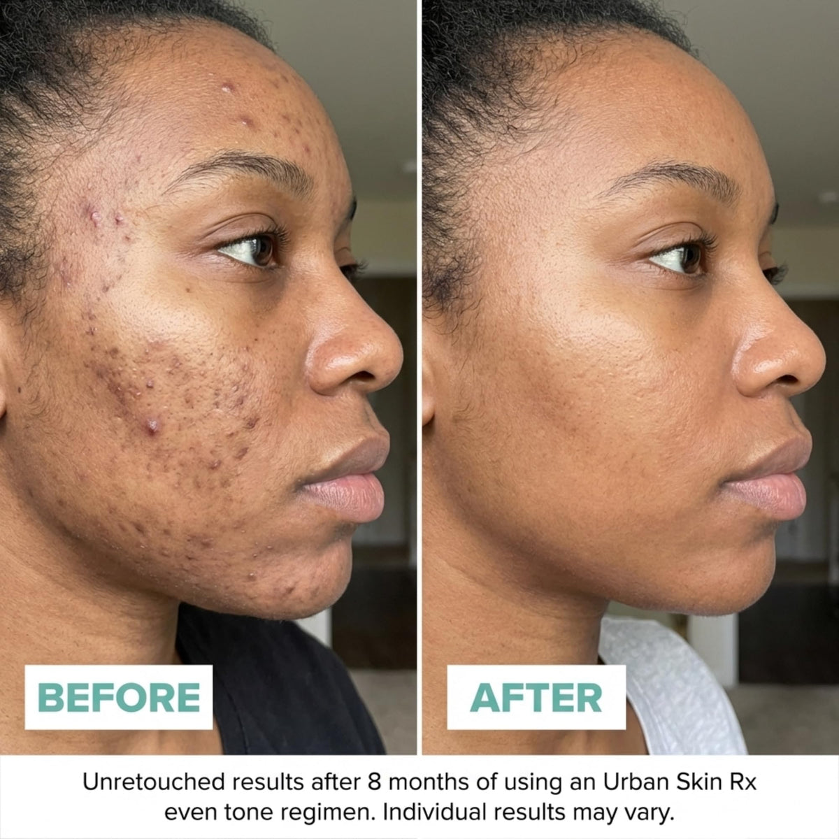 Urban Skin Rx cream in hand for scale and easy pump amount guidance and convenience