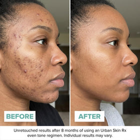 Urban Skin Rx cream in hand for scale and easy pump amount guidance and convenience