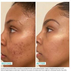 Urban Skin Rx creamy lather close-up showing smooth texture and gentle exfoliation