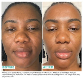 Urban Skin Rx AM serum pump dispensing lightweight brightening formula for daytime