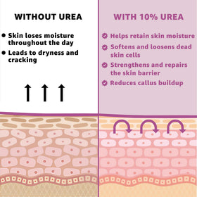 UREA LABS nightcare with socks showing intensive overnight hydration method