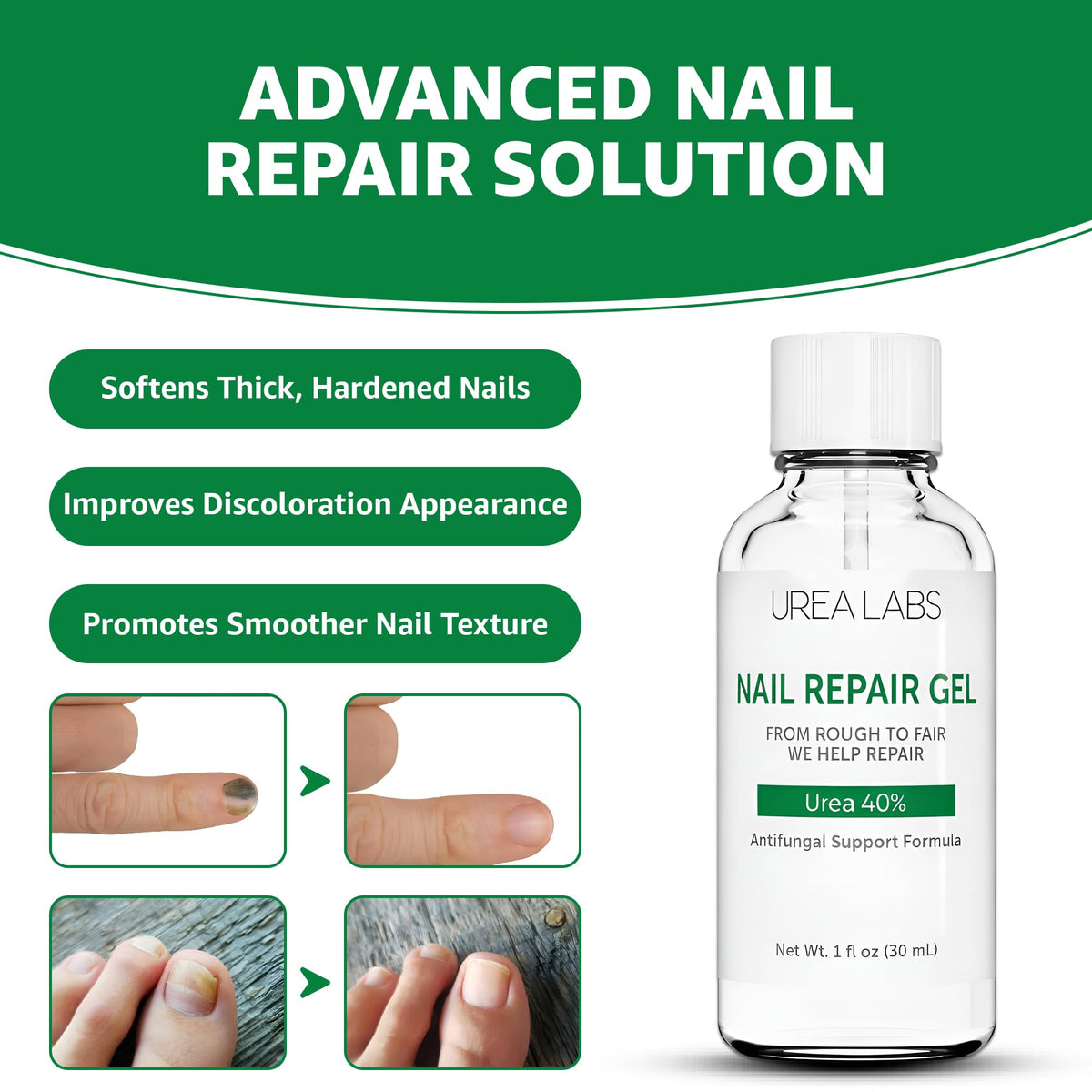 UREA LABS precision brush applicator close-up for accurate, mess-free application